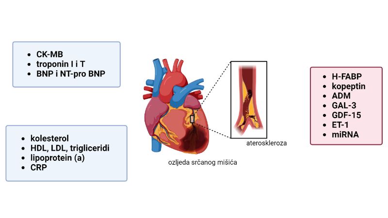 Biomarkeri za procjenu kardiovaskularnih bolesti